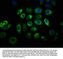IGF2R Antibody