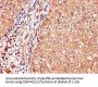 IGHMBP2 Antibody