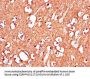 IGHMBP2 Antibody
