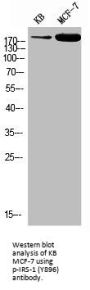 Phospho-IRS1 (Y896) Antibody
