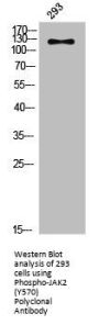 Phospho-JAK2 (Y570) Antibody