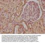 IL13RA1 Antibody