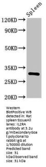 IL2RA Antibody