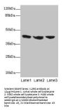 IL2RG Antibody