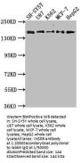 INSRR Antibody