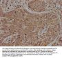 INSRR Antibody