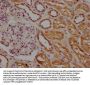 INSRR Antibody