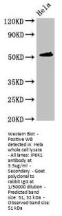 IP6K1 Antibody