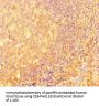 IRF5 Antibody