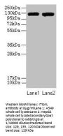 ITGAL Antibody