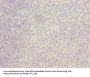 ITGAL Antibody