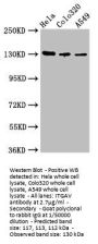 ITGAV Antibody