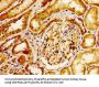 ITGAV Antibody