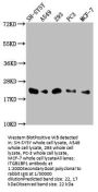 ITGB1BP1 Antibody