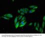 ITGB2 Antibody