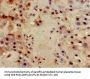 ITGB4 Antibody
