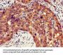 ITGB4 Antibody