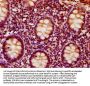 IVD Antibody