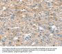 SIK1 Antibody