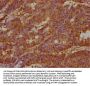 KALRN Antibody