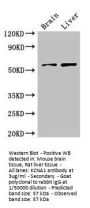 KCNA1 Antibody