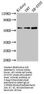 KCNAB1 Antibody