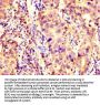 KCNAB1 Antibody