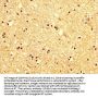 KCNAB1 Antibody
