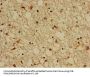 KCNIP3 Antibody