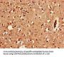 KCNJ3 Antibody