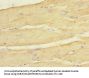 KCNJ4 Antibody
