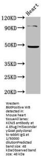 KCNJ5 Antibody