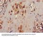 KCNK1 Antibody