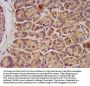 KCNK3 Antibody