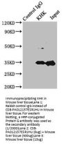KHK Antibody