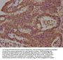 LCHN Antibody