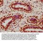 UVSSA Antibody