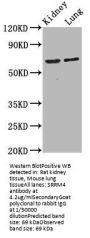 SRRM4 Antibody