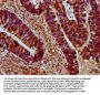 SRRM4 Antibody