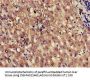 KLKB1 Antibody