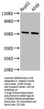 KRT16 Antibody