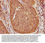 KRT16 Antibody