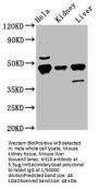 Krt18 Antibody