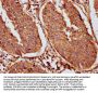 Krt18 Antibody