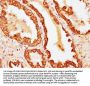 Krt18 Antibody
