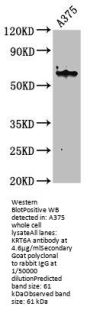 KRT6A Antibody
