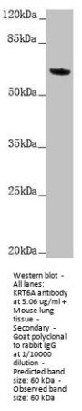 KRT6A Antibody