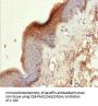 KRT6A Antibody