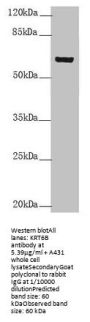 KRT6B Antibody