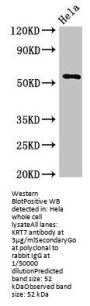 KRT7 Antibody